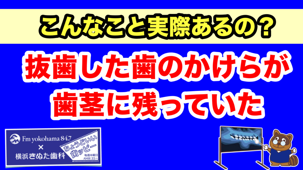 2025.11.20「ちょうどいい歯ッピー」